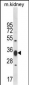 ACY3 Antibody (Center)